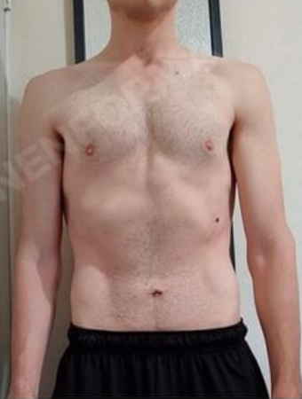 Avance del proceso de Luis