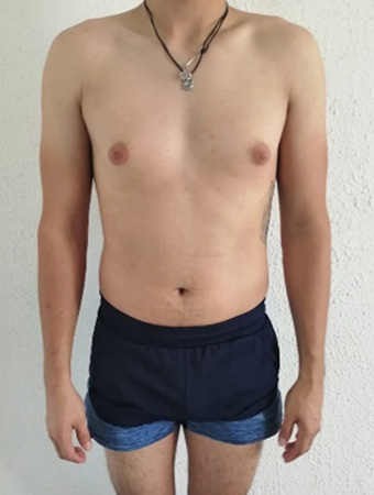 Inicio del proceso de Luis